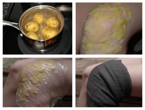 The use of potatoes to warm joint