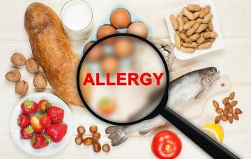 What is important to know about food allergies?